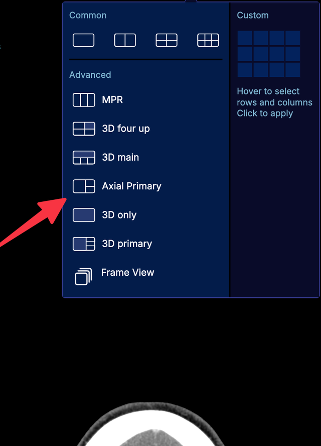 layoutSelector.advancedPresetGenerator