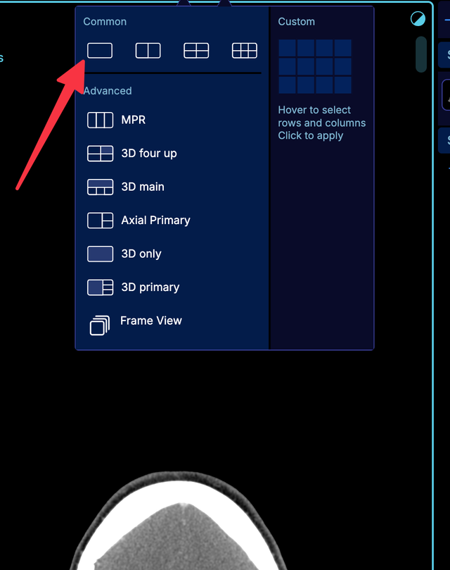 layoutSelector.commonPresets