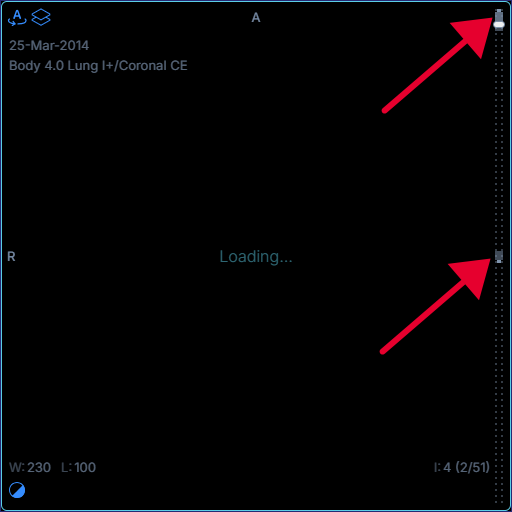 viewportScrollbar.showLoadedEndpoints: Loaded-range endpoint caps