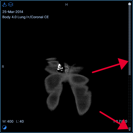 viewportScrollbar.showLoadedFill: Loaded/cached fill track