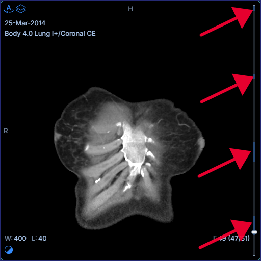 viewportScrollbar.showViewedFill: Viewed fill track