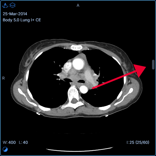 viewportScrollbar.variant: legacy
