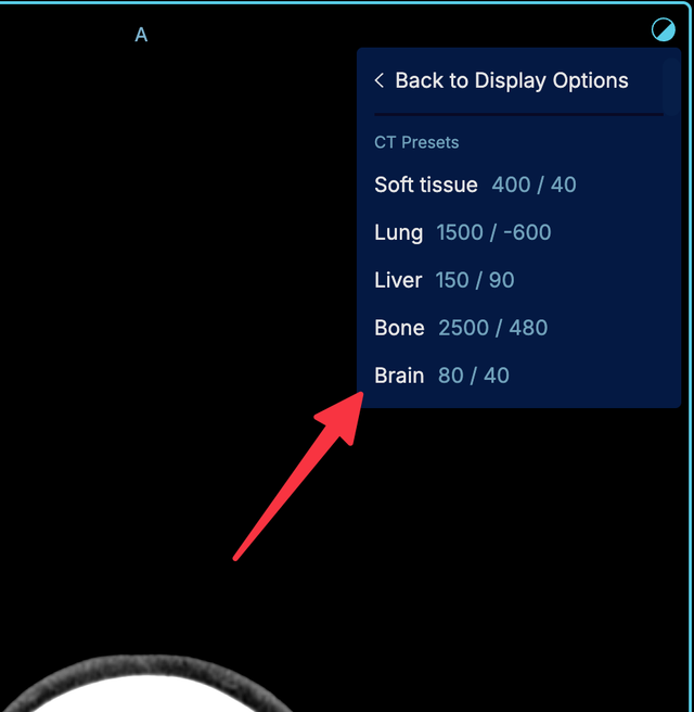 cornerstone.windowLevelPresets